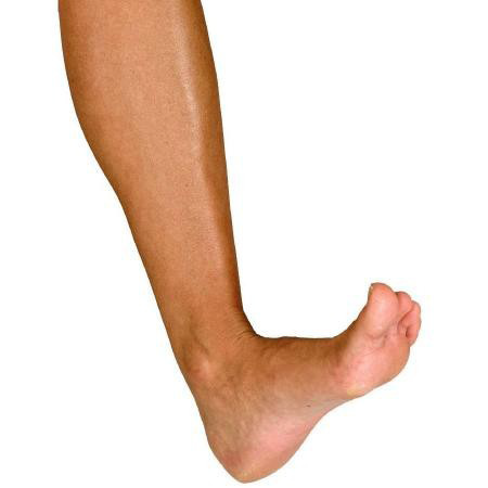 Ankelskinne-aircast_øv_2.png